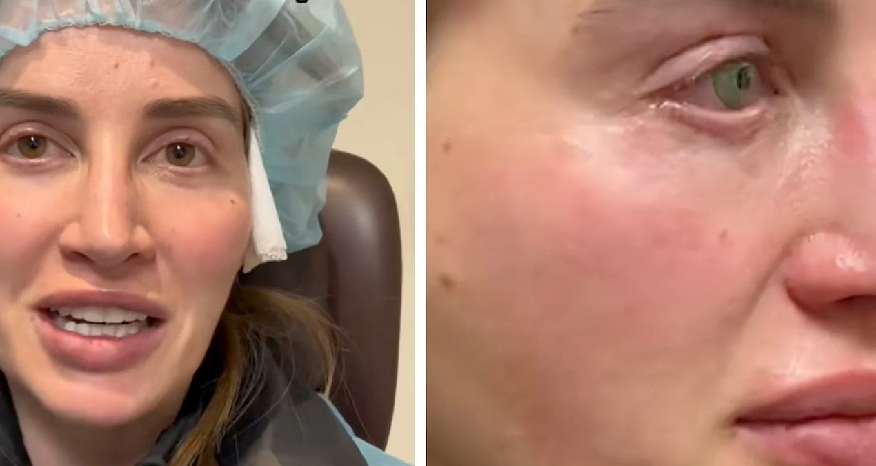 9 milyon kisi bu gozleri konusuyor kalici olarak yaptirdi gorenler dondu kaldi J4CqCRIK