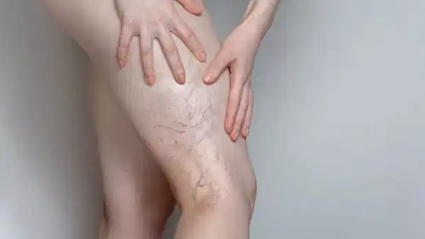 uzmanindan uyari ileri derecedeki varis hayati tehdit edebilir rzBvtCRf.jpg